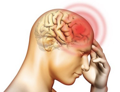 Chấn thương sọ não và Alzheimer gây suy giảm nhận thức tương tự nhau